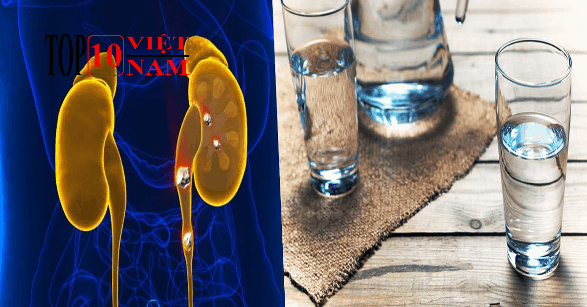 Có Thể Giúp Điều trị sỏi thận