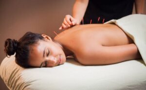 Top10Vn châm cứu bấm huyệt