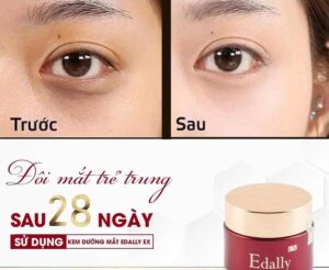 Kem dưỡng mắt Edally Ex