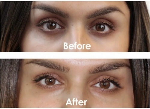Iluma Intense Brightening Eye Creme giúp gương mặt sáng bừng sức sống