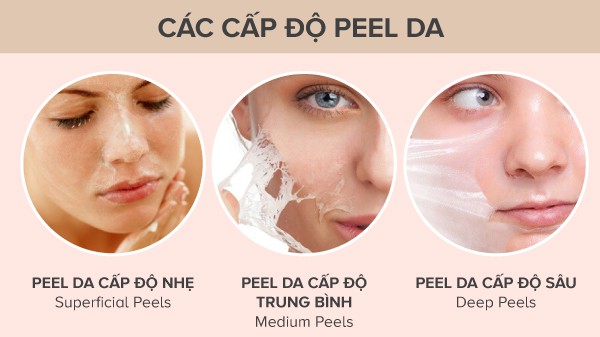 Các cấp độ Peel da - thay da sinh học