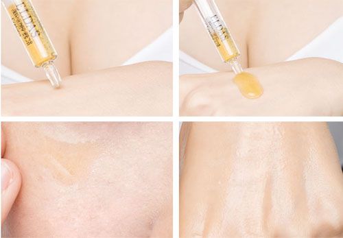 Công dụng của Serum Eldas Eg Tox Program