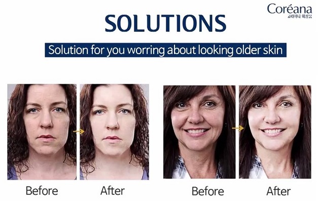 Ưu và nhược điểm của tế bào gốc Eldas Serum