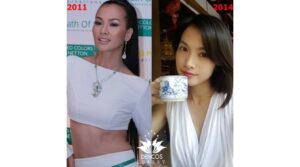 Anh Thư căng da mặt đẹp - Top10Vn