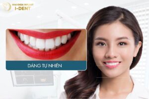 Top10Vn - Kiểu răng giả đẹp dáng tự nhiên